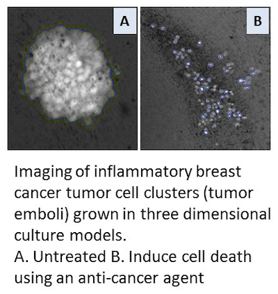 Imaging of breast cancer cells grown in 3D culture models