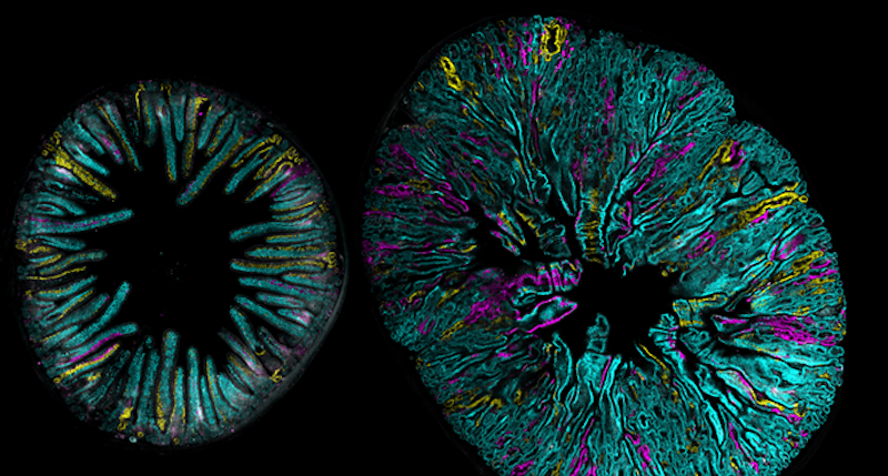 Image from the crainbow study