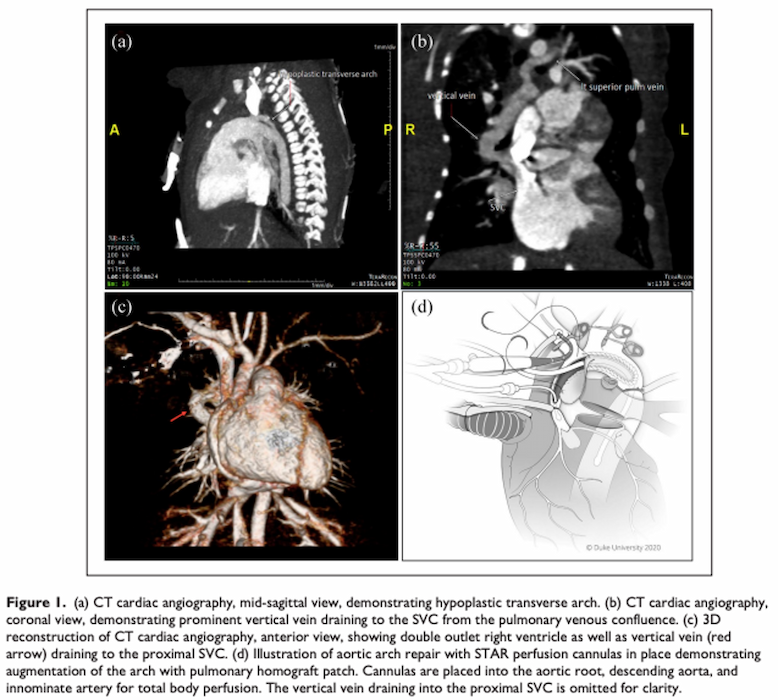 JCI Insight Research Article Cardiac Angiography