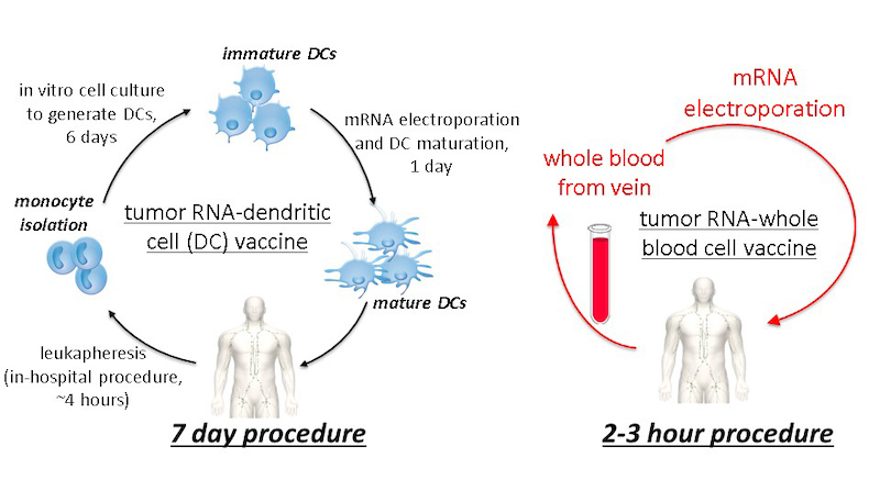 Illustration of a 7-day procedure and a 2- to 3-hour procedure