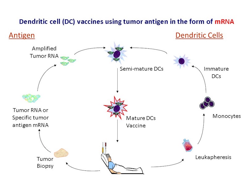 Illustration of DC vaccines using tumor antigen in the form of mRNA