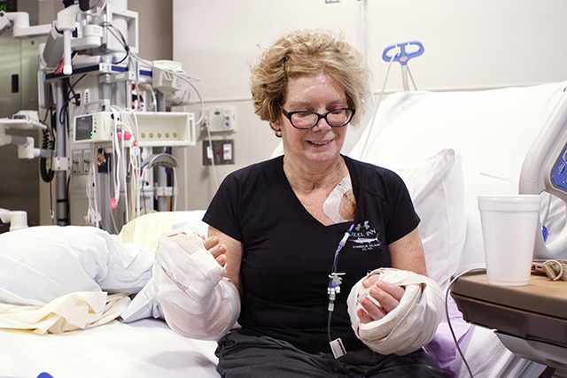 Debra Kelly, first bilateral hand transplant recipient in North Carolina looks at her new hands