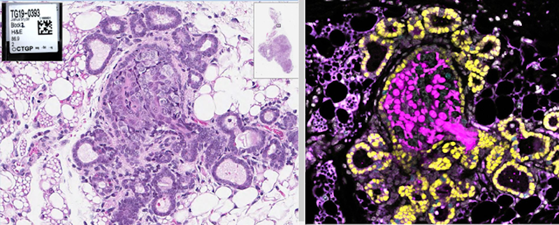 H&E staining images