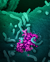 Microscope image of the SARS-Cov-2 virus (magenta  objects) emerging from the  surface of cells.