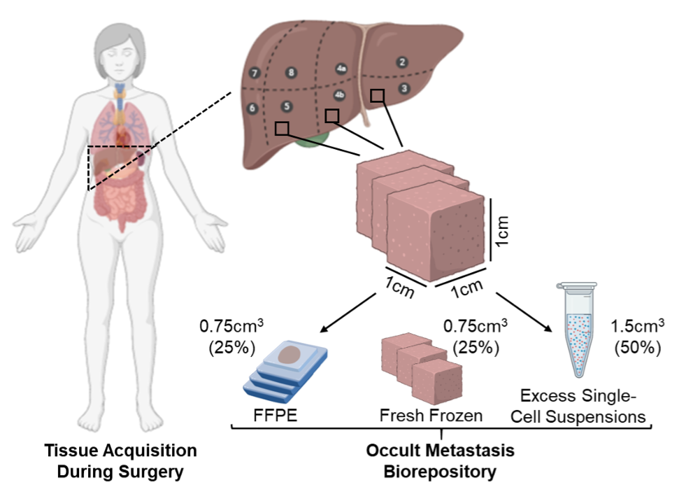Tissue acquisition during surgery