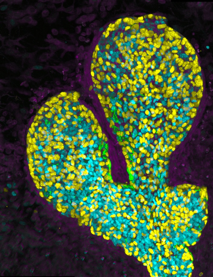 Fluorescently labeled terminal end bud of the mammary gland