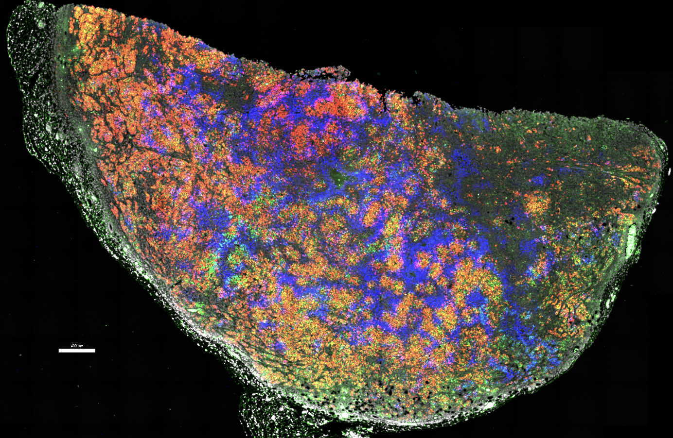 RNAscope in situ hybridization on a mouse mammary tumor