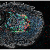 Microscopic image of cellular structures with multicolored markers in tissue.