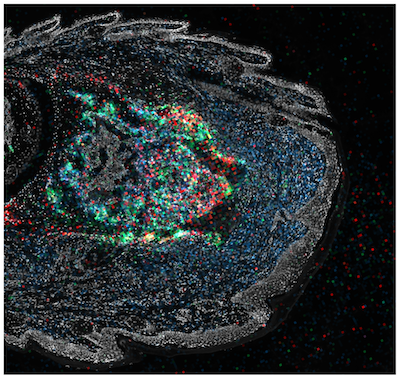 Microscopic image of cellular structures with multicolored markers in tissue.