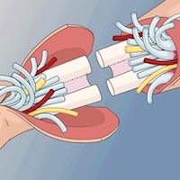 illustration of a hand transplant