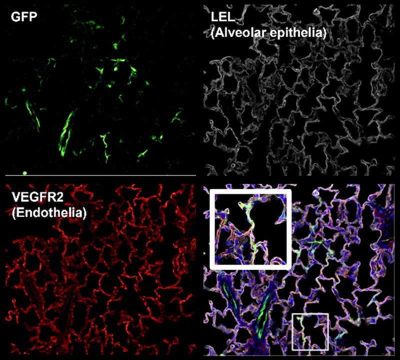Figure Z: Transgene expression can be enriched in particular cell types based on the AAV serotype used.