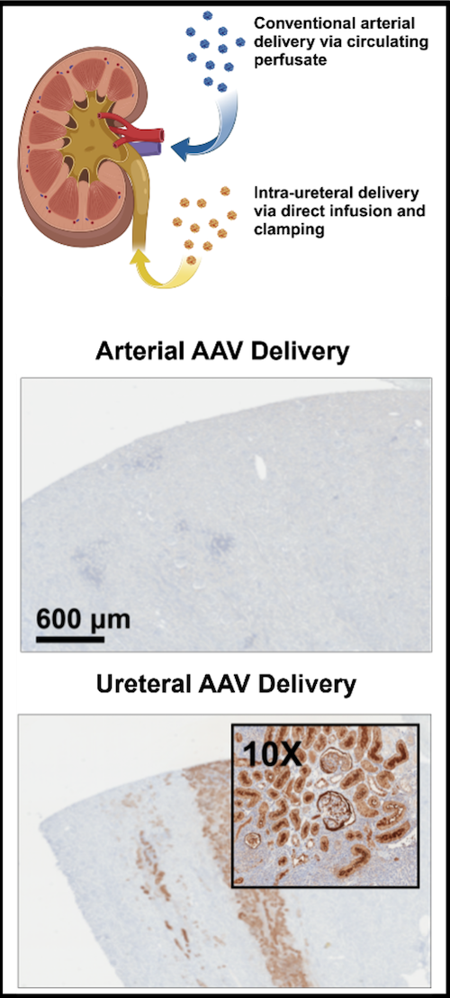 Figure A: Route-dependent AAV-mediated gene expression in kidney.