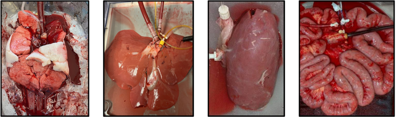 Images of organs