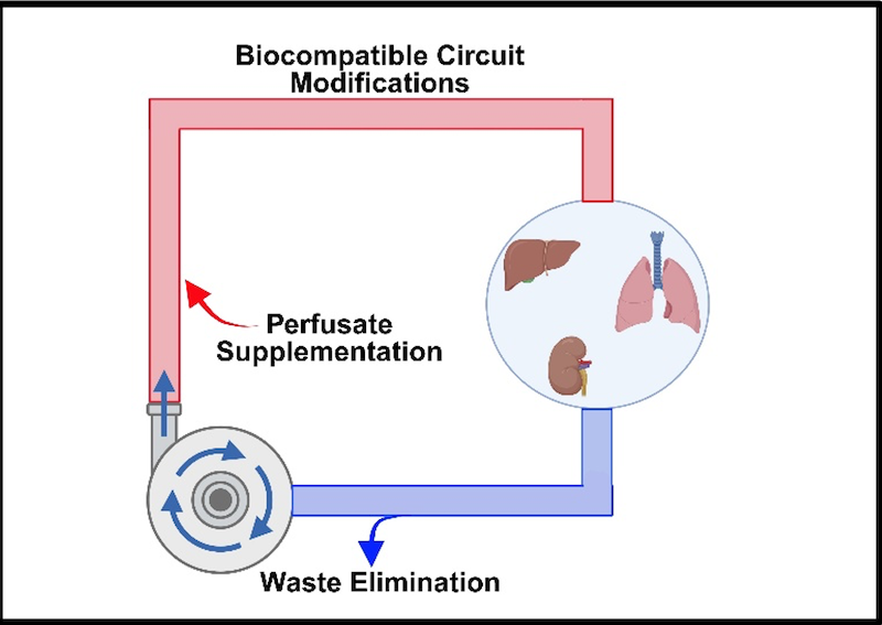 Key Challenges for Perpetual Organ Perfusion.