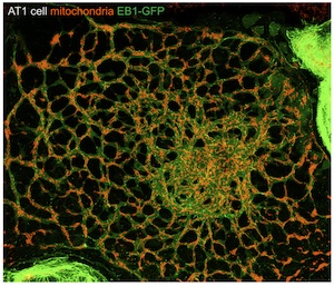 A photo depicting AT1 cell mitochondria under a microscope