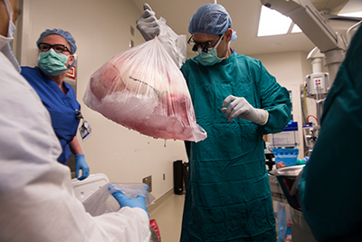 Dr. Matthew Hartwig examines preserved lungs