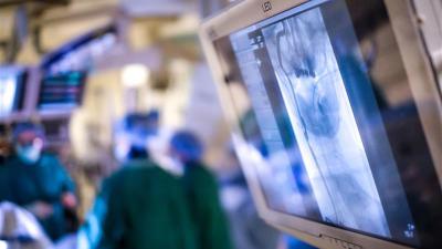 Photo of the OR with a radiograph on a screen in the foreground and the OR team working in the background