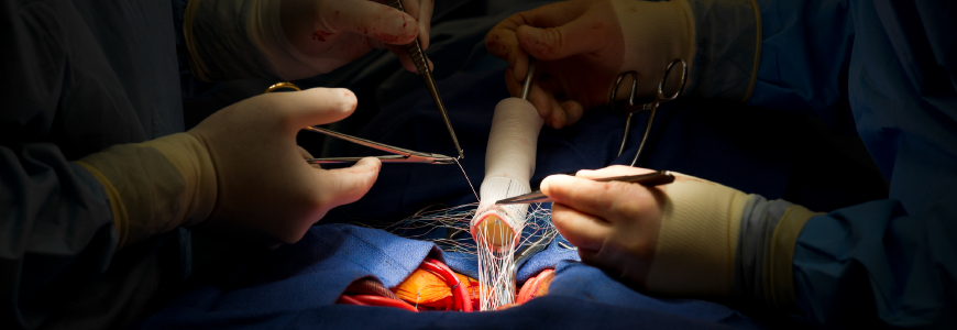 Surgeon hands operating on a heart