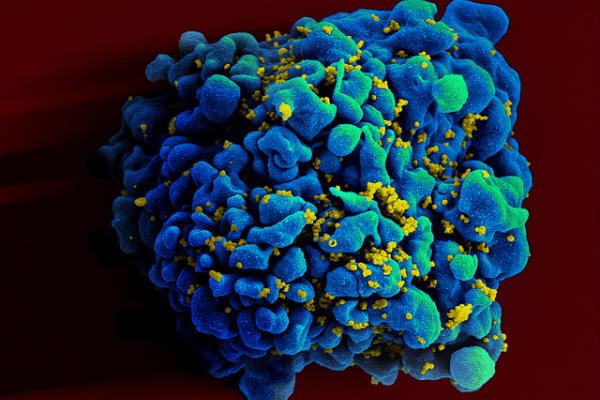 HIV-infected T cell