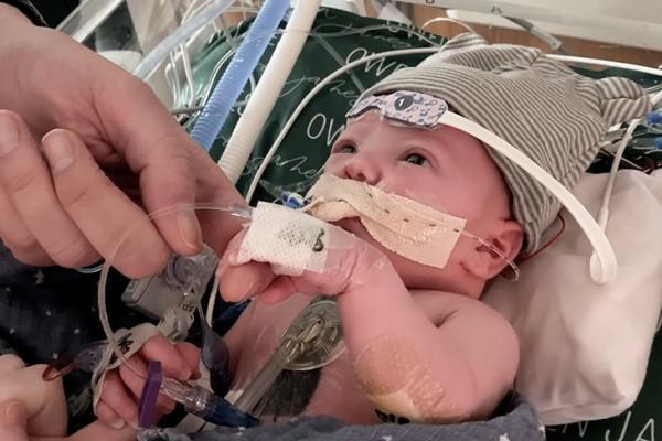 Partial Heart Transplant Patient Baby Owen