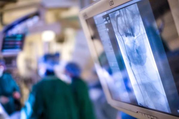 Photo of the OR with an angiogram on a screen in the foreground and the OR team working in the background