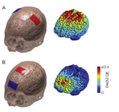 Brain Scan