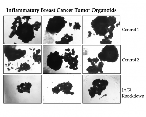 Inflammatory breast cancer tumor organoids