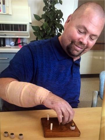 Hand transplant patient Mr. Daniel Benner picks up rings during physical therapy