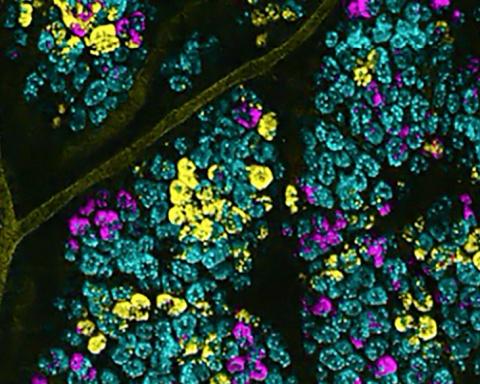 High magnification image of fluorescent intestinal stem cells. Each fluorescent color is used as a barcode to visualize human colon cancer causing mutations in mice.