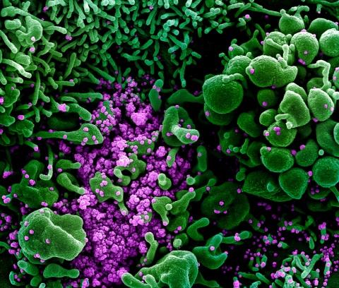 Electron Microscopy image of SARS-CoV-2 virus