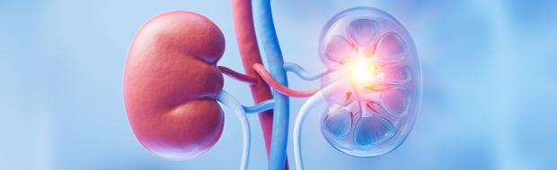 Graphic illustration depicting kidney transplant