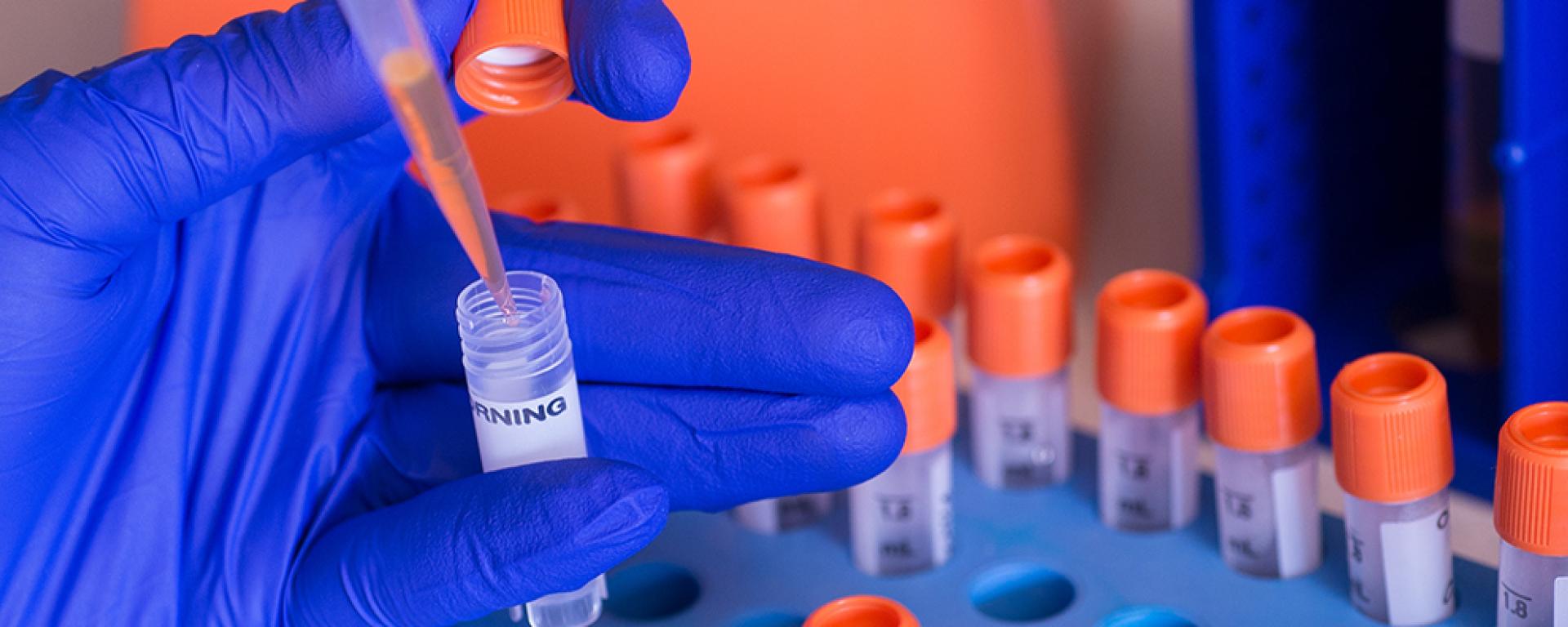 Lab test tubes