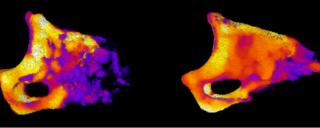 Two colorful 3D models of nasal bone structure with cellular detail.