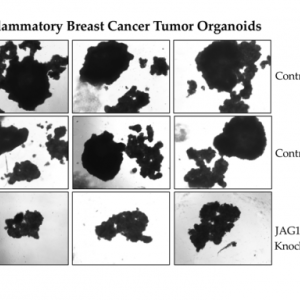 Inflammatory breast cancer tumor organoids