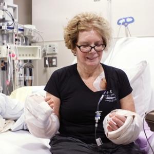 Debra Kelly, recipient of first bilateral hand transplant in North Carolina, looks at her new hands